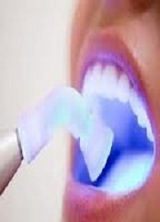cosmetic dentist new york city | nyc teeth whitening